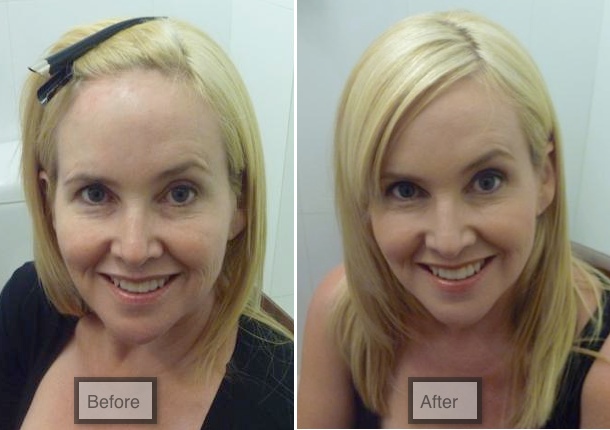Jane Iredale before and after