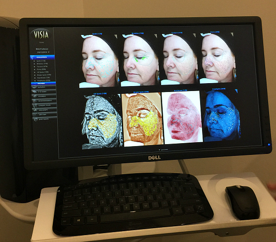 Rationale Clinic Brisbane UV imaging